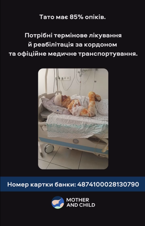 Получил 85% ожогов тела: в Киеве спасают отца маленького Назарчика, который пострадал в результате российской атаки