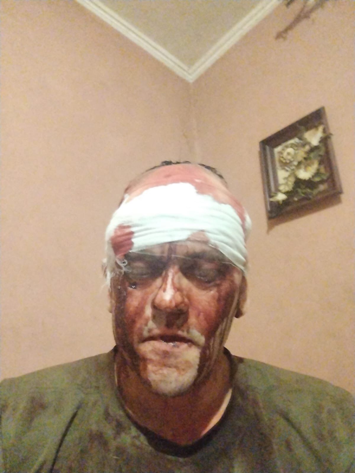 "Невиданная жестокость": в сети сообщили об избиении ветерана на Львовщине, в полиции отреагировали. Фото