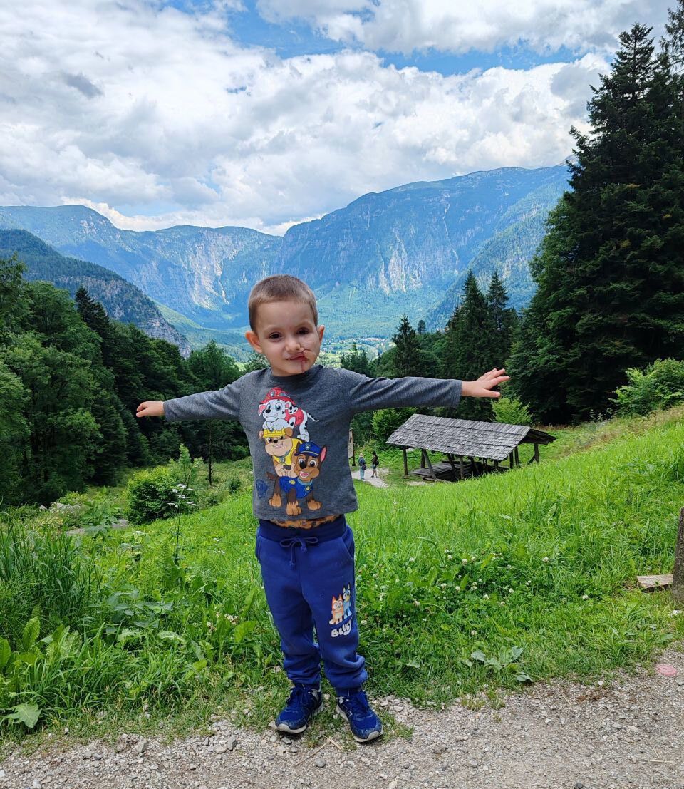 Було накладено 500 швів, дитина росте в лікарнях: як склалась доля хлопчика, який постраждав від вибуху на виставці в Чернігові у 2022 році. Фото