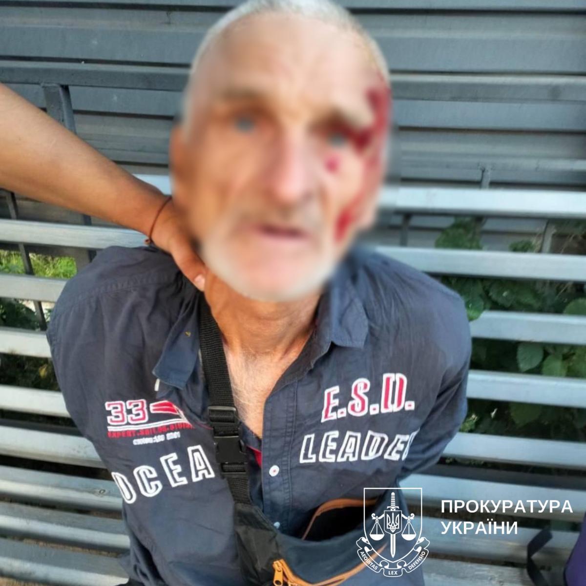 У Києві засуджений за вбивство почав грабувати й ґвалтувати жінок через два місяці після виходу на волю. Подробиці та фото