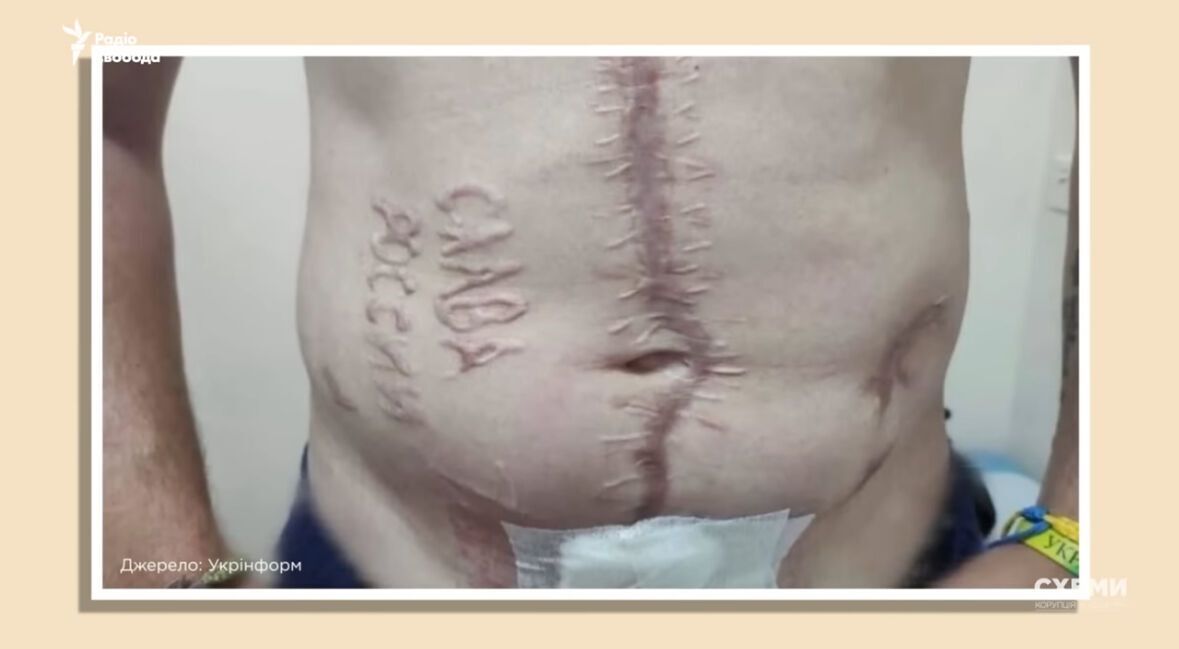 Працюють у лікарні Краснодара: медіа розкрили, хто з російських хірургів міг випалити на тілі українського бранця "слава Росії". Фото