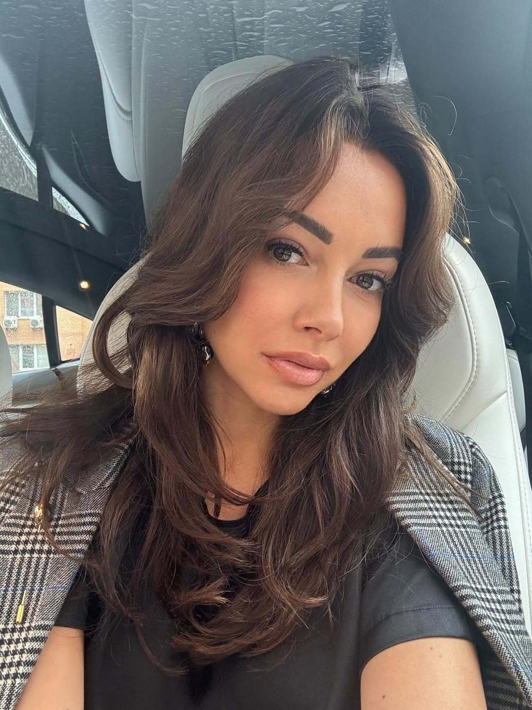 Не могла смотреть на свое лицо: прима-балерина Кухар шокировала историей, как потеряла сознание в эфире после визита к косметологу