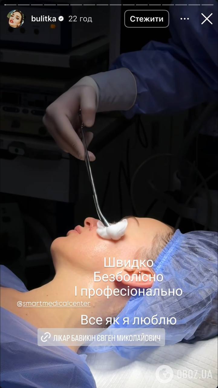 Звезда "Дизель шоу" сделала пластическую операцию на лице. Фото до и после