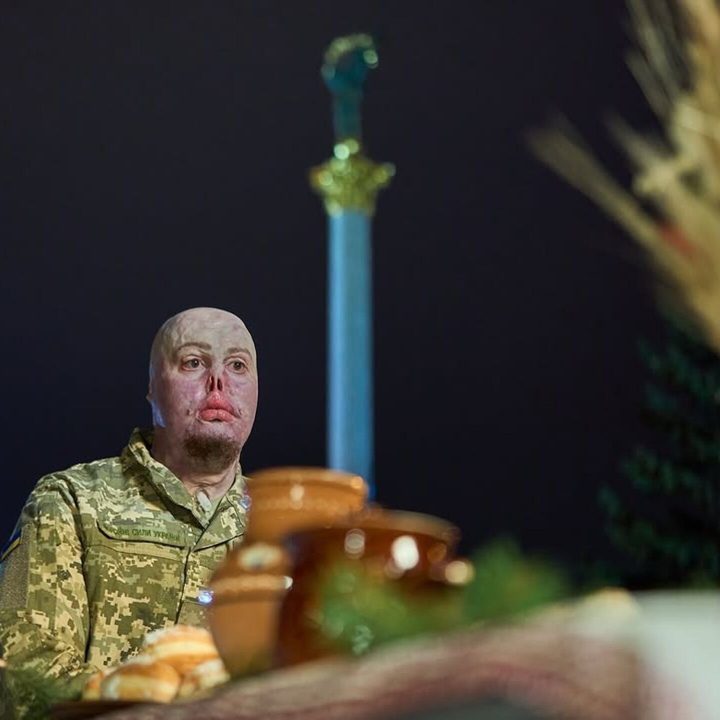 "Мені подобається все в моєму житті". Незламний ветеран, який отримав важкі опіки, знайшов кохання в інтернеті. Фото пари