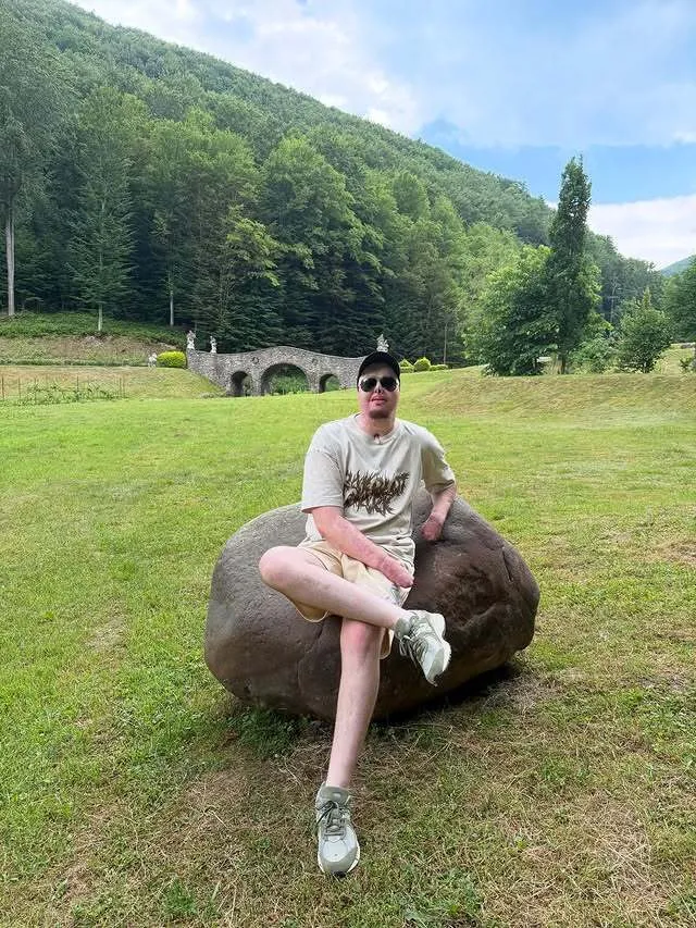 "Мені подобається все в моєму житті". Незламний ветеран, який отримав важкі опіки, знайшов кохання в інтернеті. Фото пари