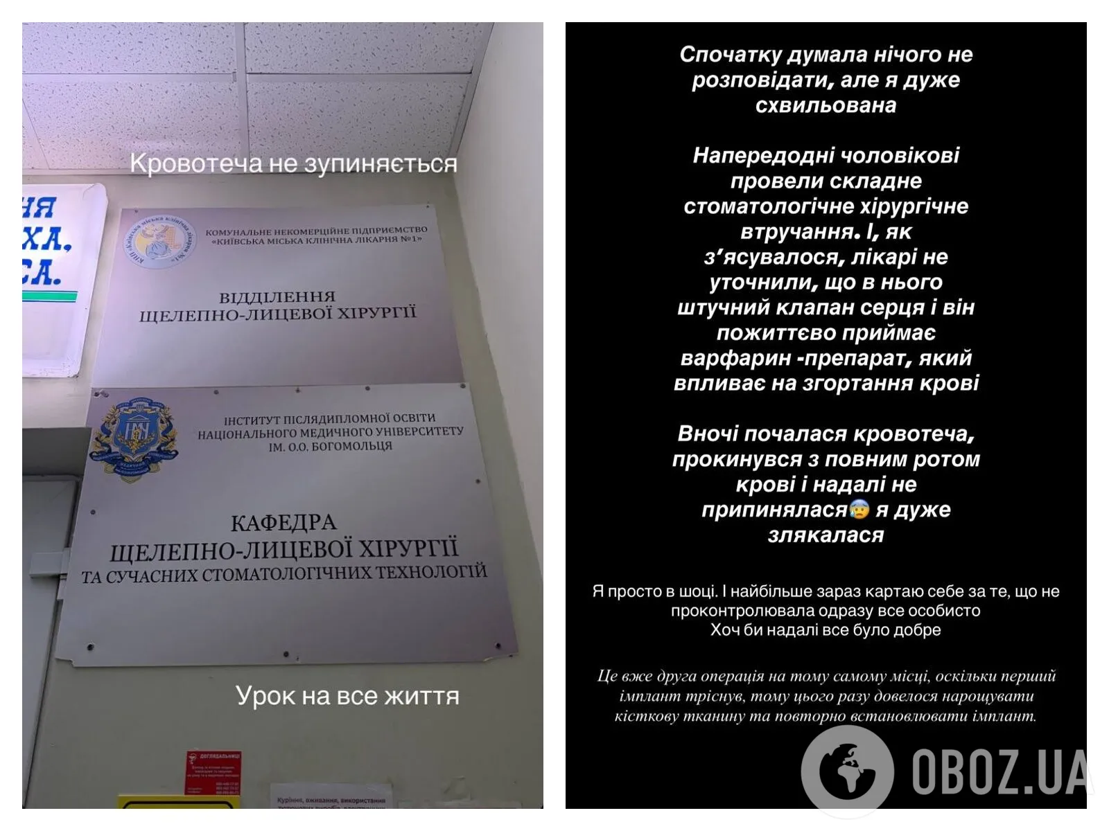 Дружина Віктора Павліка вперше показала обличчя зірки після невдалого лікування зубів та екстреної операції