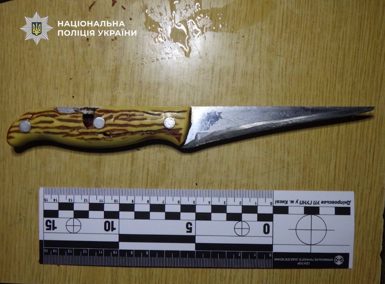 В Киеве женщина набросилась с ножом на сожителя из-за его ревности: мужчина в больнице. Подробности и фото