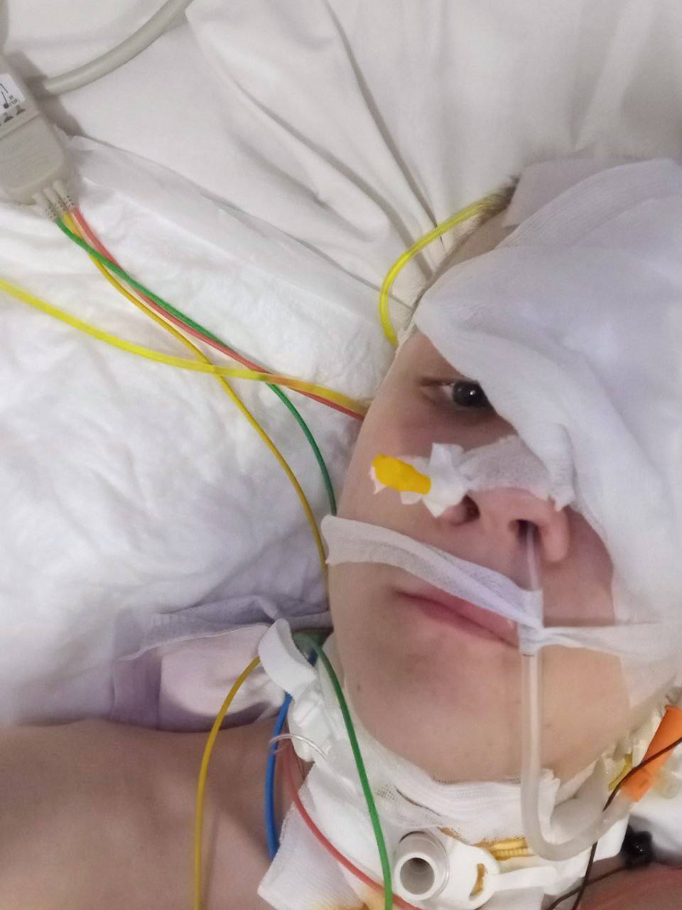 Впал в кому на следующий день после 16-летия: во Львове спасли подростка, который едва не погиб из-за гноя в мозге