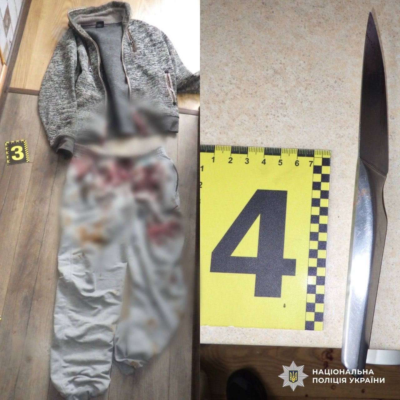 В Киеве ссора братьев-близнецов едва не закончилась жестоким убийством. Подробности и фото