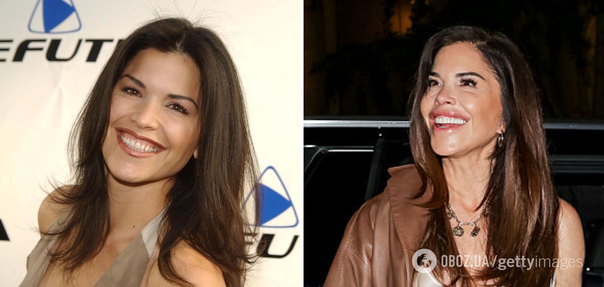 Як змінювалася зовнішність дружини мільярдера Безоса: пластичний хірург назвав процедури, які могла робити Лорен Санчес. Фото тоді і зараз