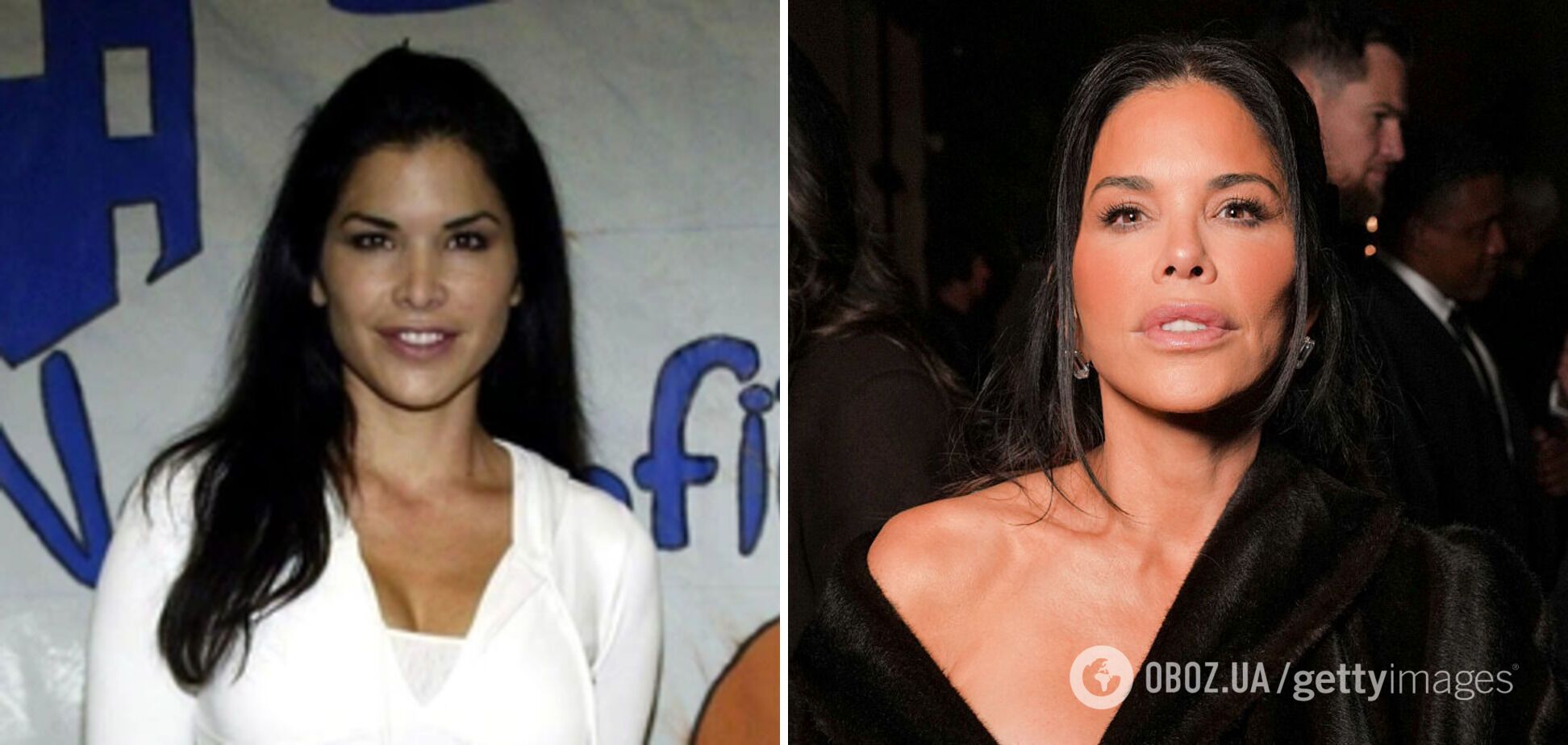 Як змінювалася зовнішність дружини мільярдера Безоса: пластичний хірург назвав процедури, які могла робити Лорен Санчес. Фото тоді і зараз