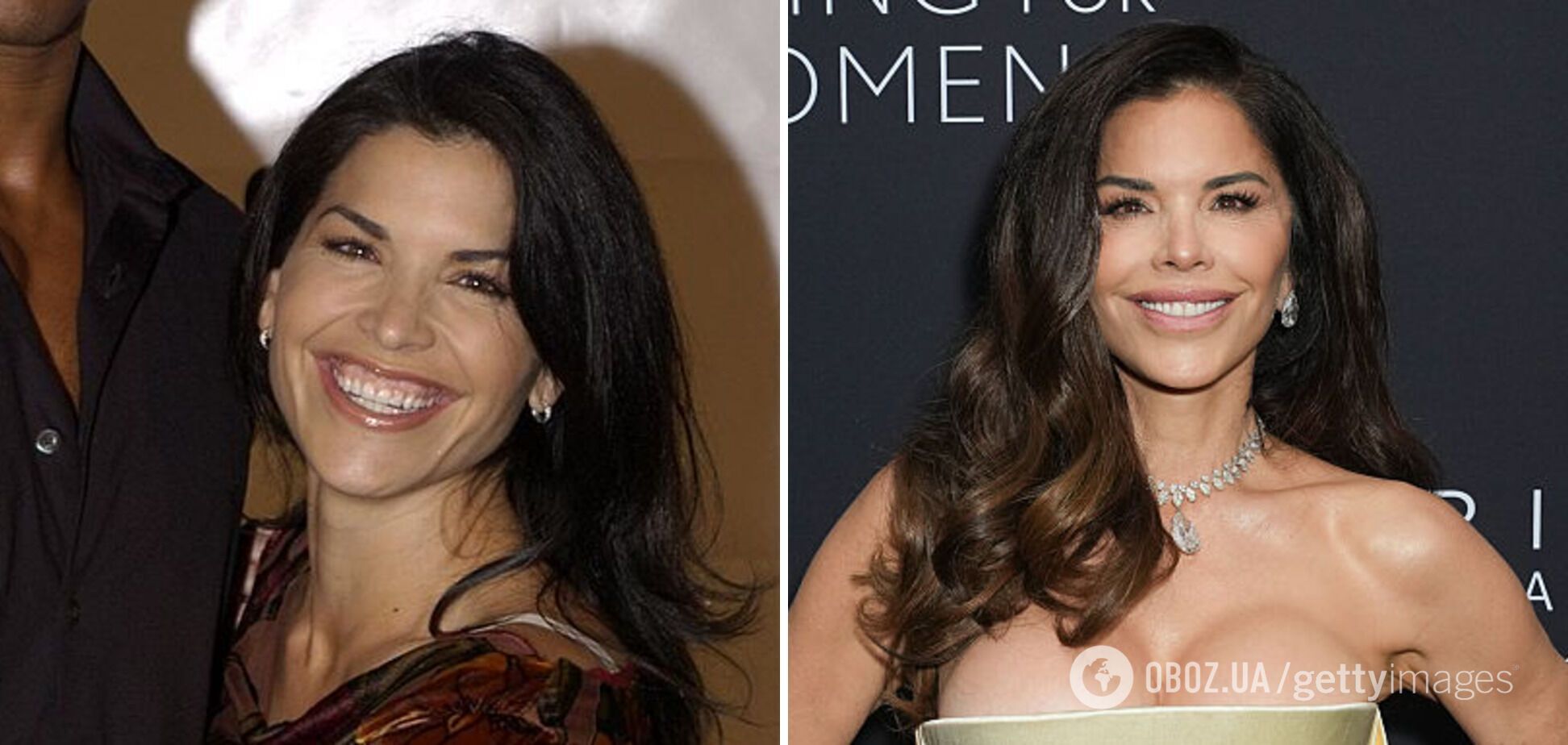 Як змінювалася зовнішність дружини мільярдера Безоса: пластичний хірург назвав процедури, які могла робити Лорен Санчес. Фото тоді і зараз