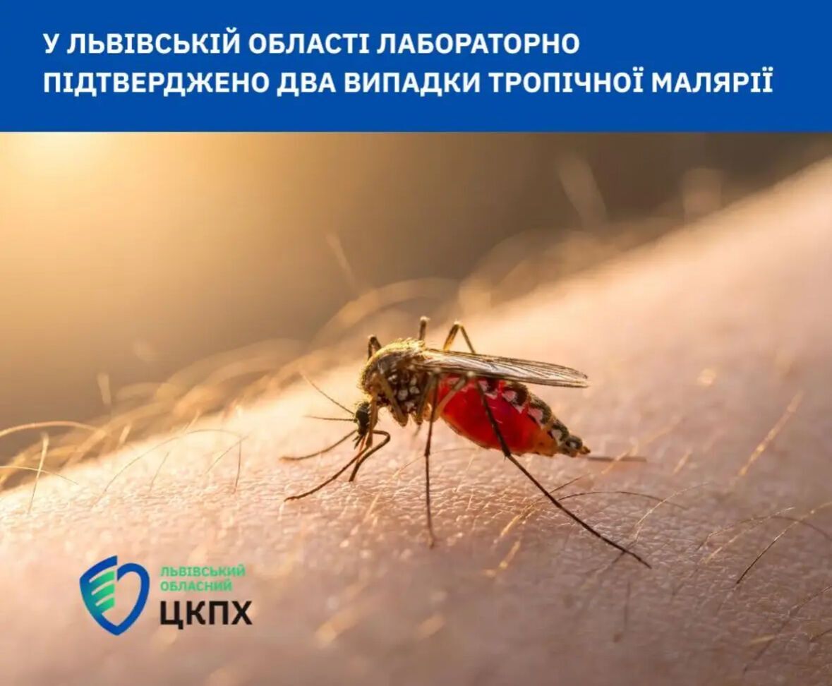 На Львівщині у двох жінок виявили малярію після відпочинку на Занзібарі: які симптоми хвороби