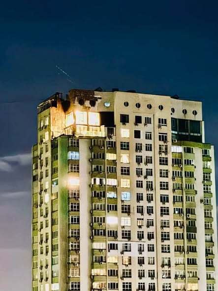 ДТП за кордоном змінила обличчя ведучого телемарафону Андрія Ковальського: який вигляд він має тепер