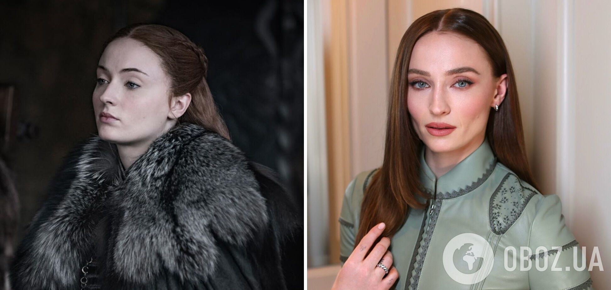 Вона зіпсувала своє обличчя: мережа обговорює невпізнанну зірку "Гри престолів", яка зіграє нову Лару Крофт. Фото тоді і зараз