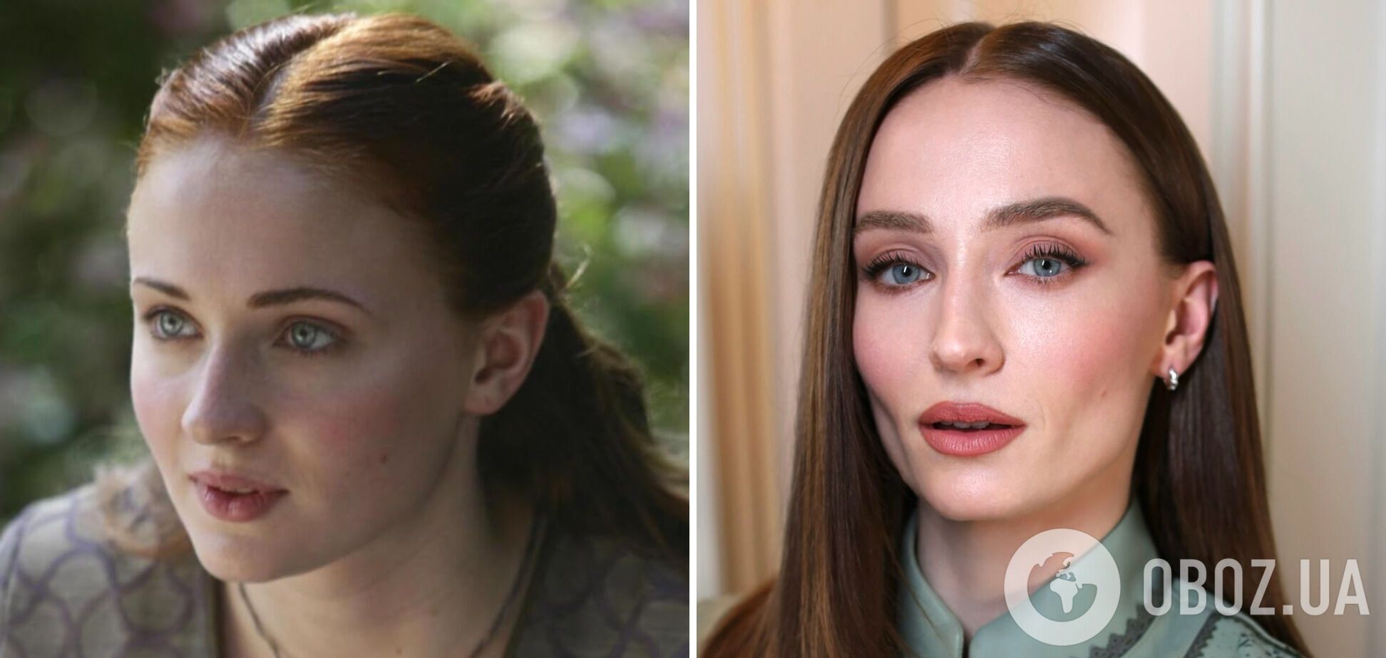 Вона зіпсувала своє обличчя: мережа обговорює невпізнанну зірку "Гри престолів", яка зіграє нову Лару Крофт. Фото тоді і зараз