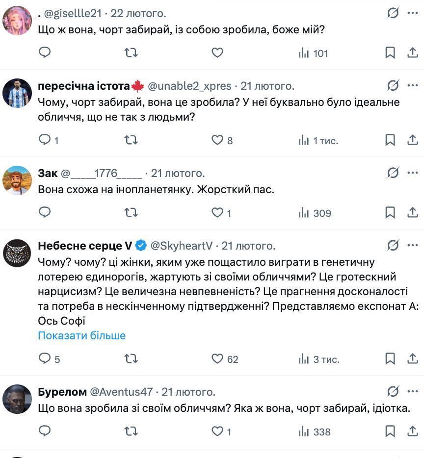 Вона зіпсувала своє обличчя: мережа обговорює невпізнанну зірку "Гри престолів", яка зіграє нову Лару Крофт. Фото тоді і зараз