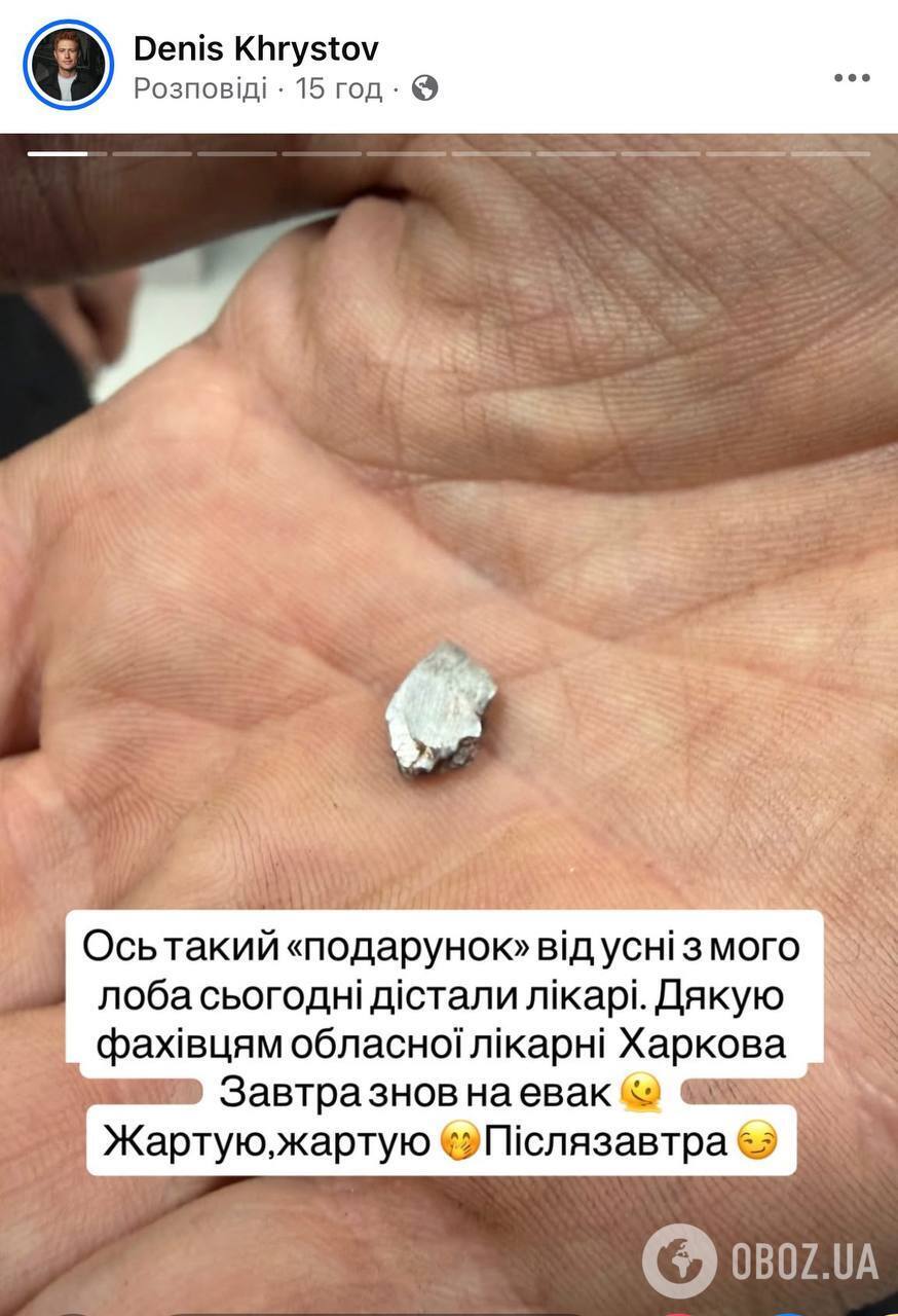 Російський дрон влучив у авто відомого ведучого та волонтера: закривавлений "Голландець" звернувся до окупантів трьома словами