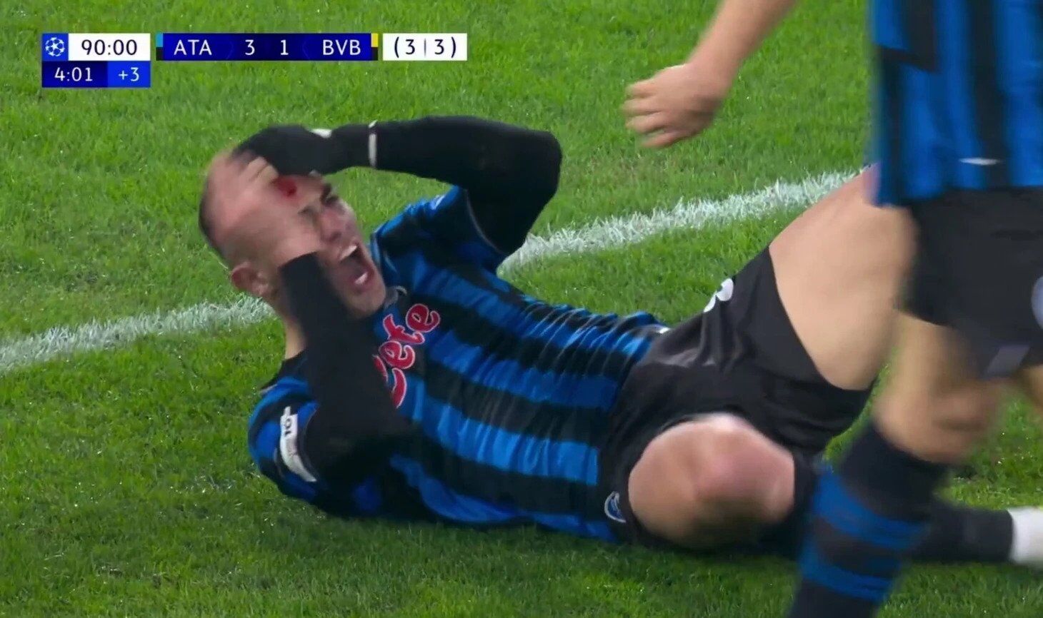 Футболіст "Боруссії" на 94-й хвилині вдарив шипами в лоб супернику та позбавив свій клуб Ліги чемпіонів. Відео