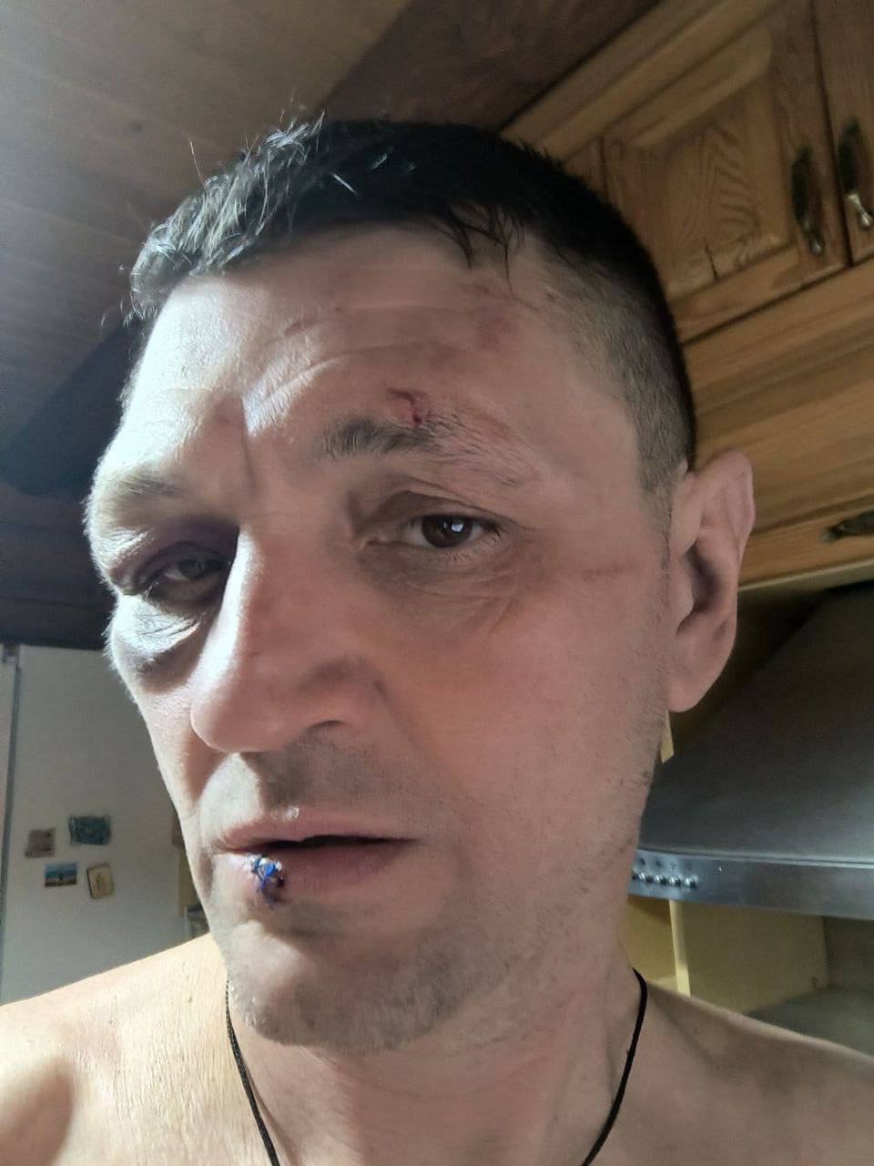 "Пытался совершить нападение на военных": в Харьковском ТЦК прокомментировали ситуацию с избиением ветерана войны. Фото