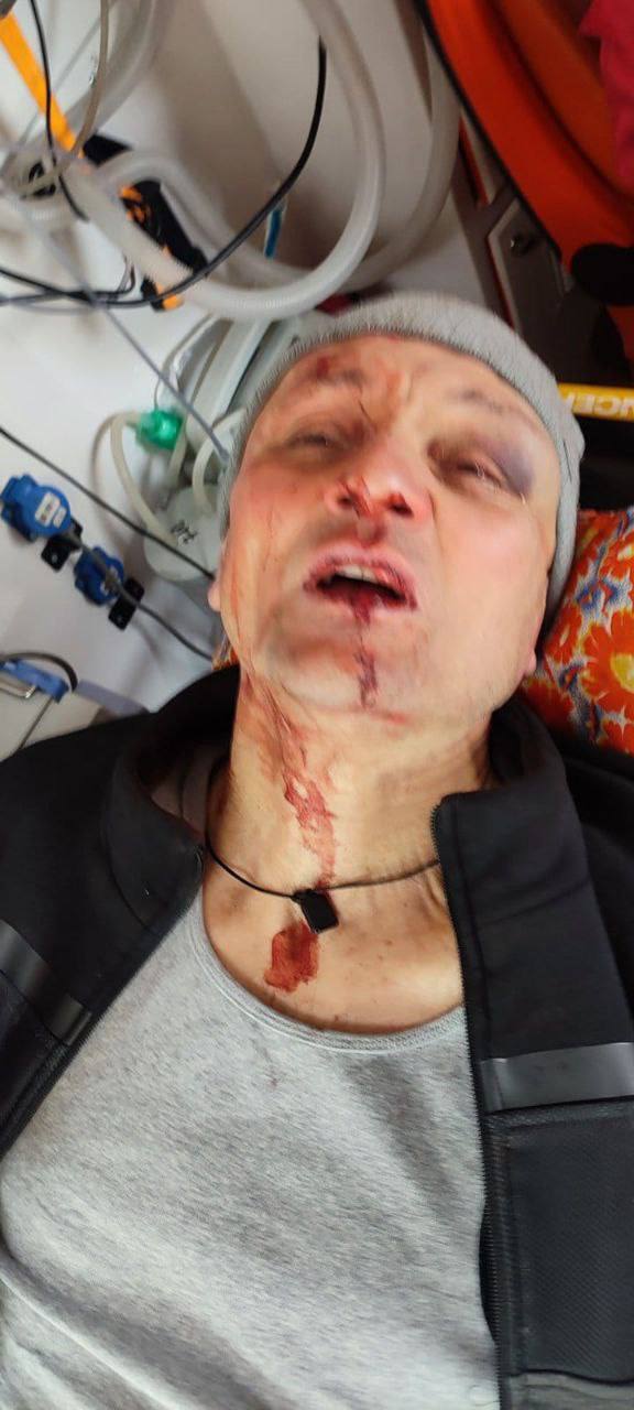 "Пытался совершить нападение на военных": в Харьковском ТЦК прокомментировали ситуацию с избиением ветерана войны. Фото