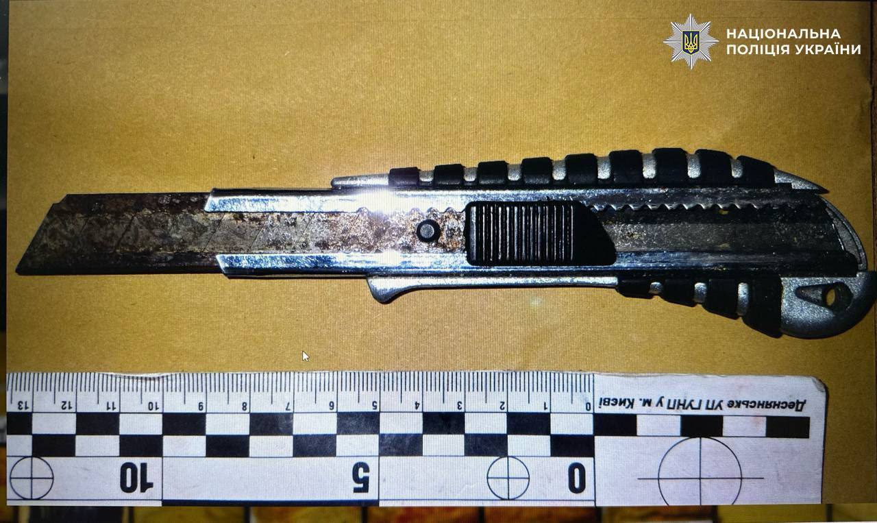 У Києві на Троєщині чоловік порізав підлітку обличчя канцелярським ножем. Подробиці та фото