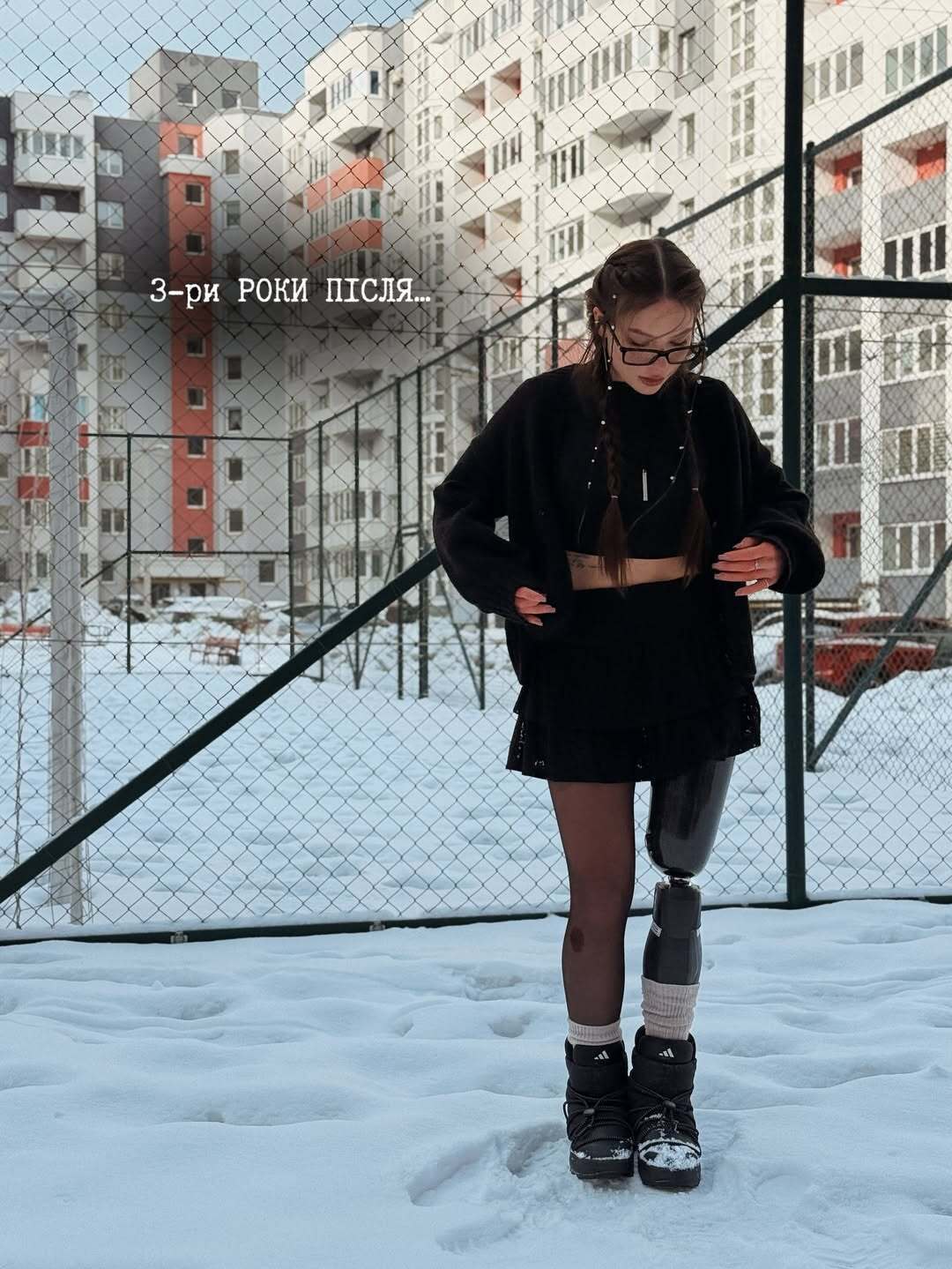 Ветеранка-победительница "Танцев со звездами" честно призналась, почему бросила парня через два месяца после потери ноги