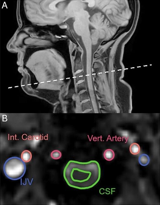 Позіхання роблять дещо дивне з нашим мозком: вчені зробили відкриття