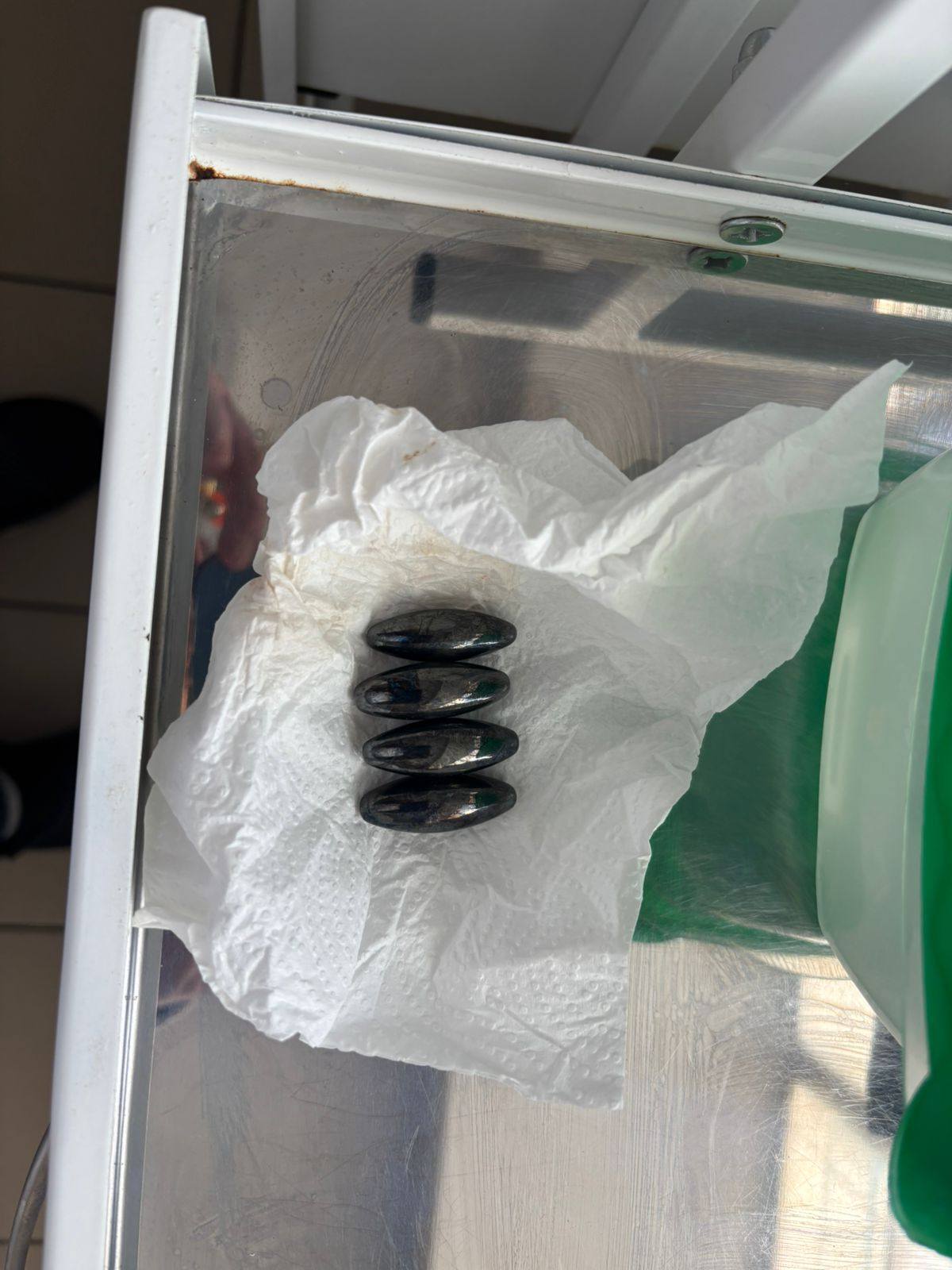 "Небезпечна іграшка": у Черкасах медики врятували дитину, яка проковтнула п'ять магнітів. Фото