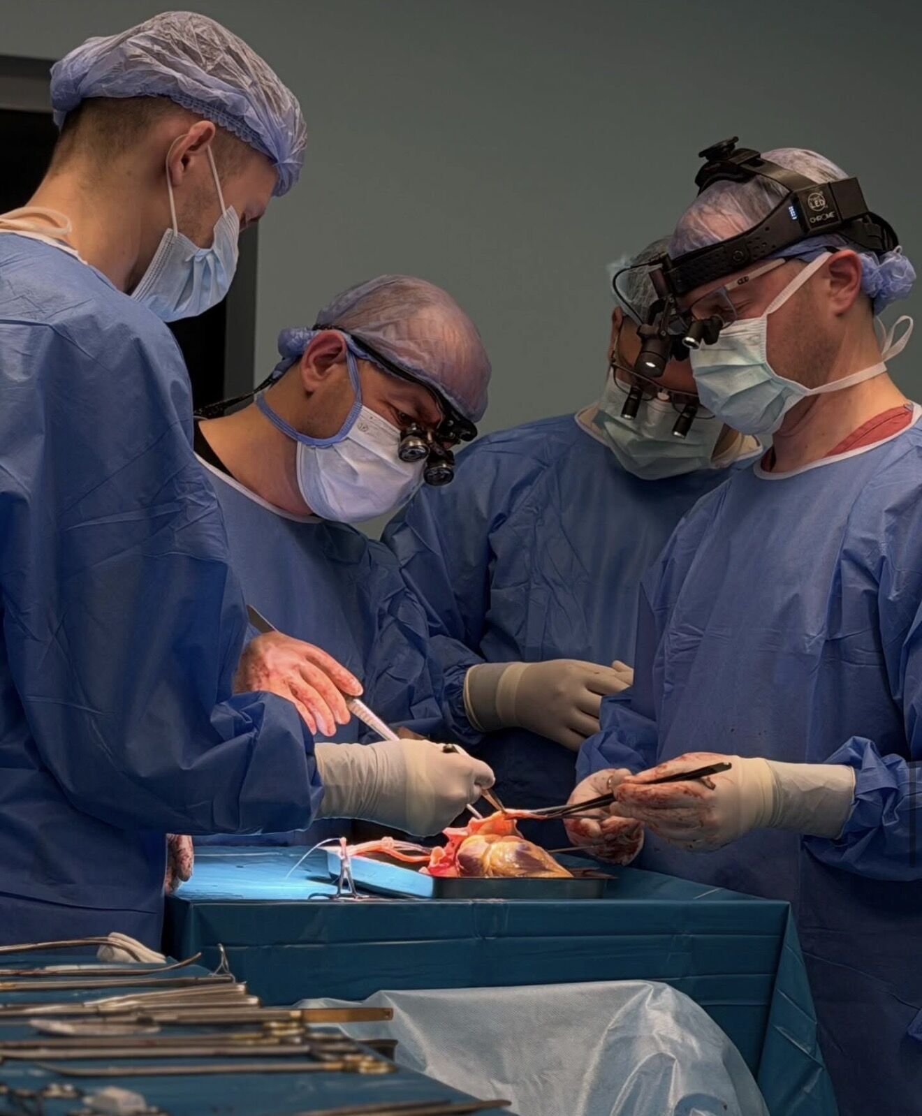 У Львові завдяки посмертному донору врятували чотири життя: було проведено мультиорганну трансплантацію. Фото