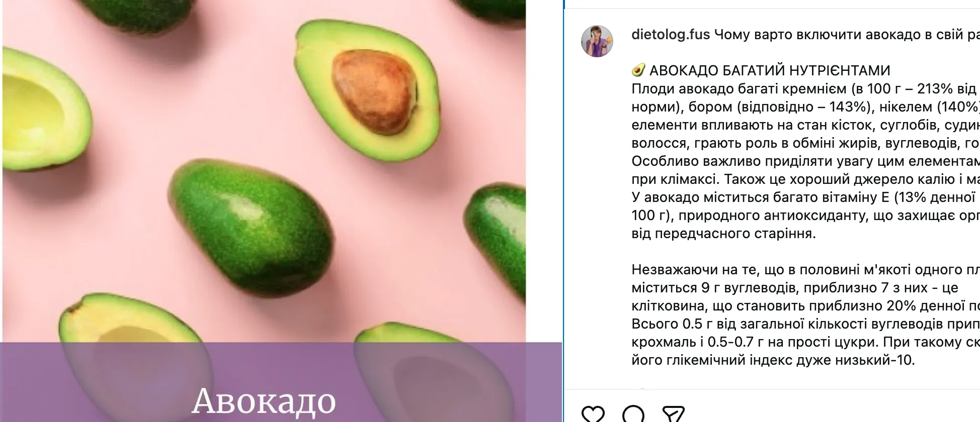 Почему обязательно стоит добавить авокадо в свой рацион: советы от специалиста