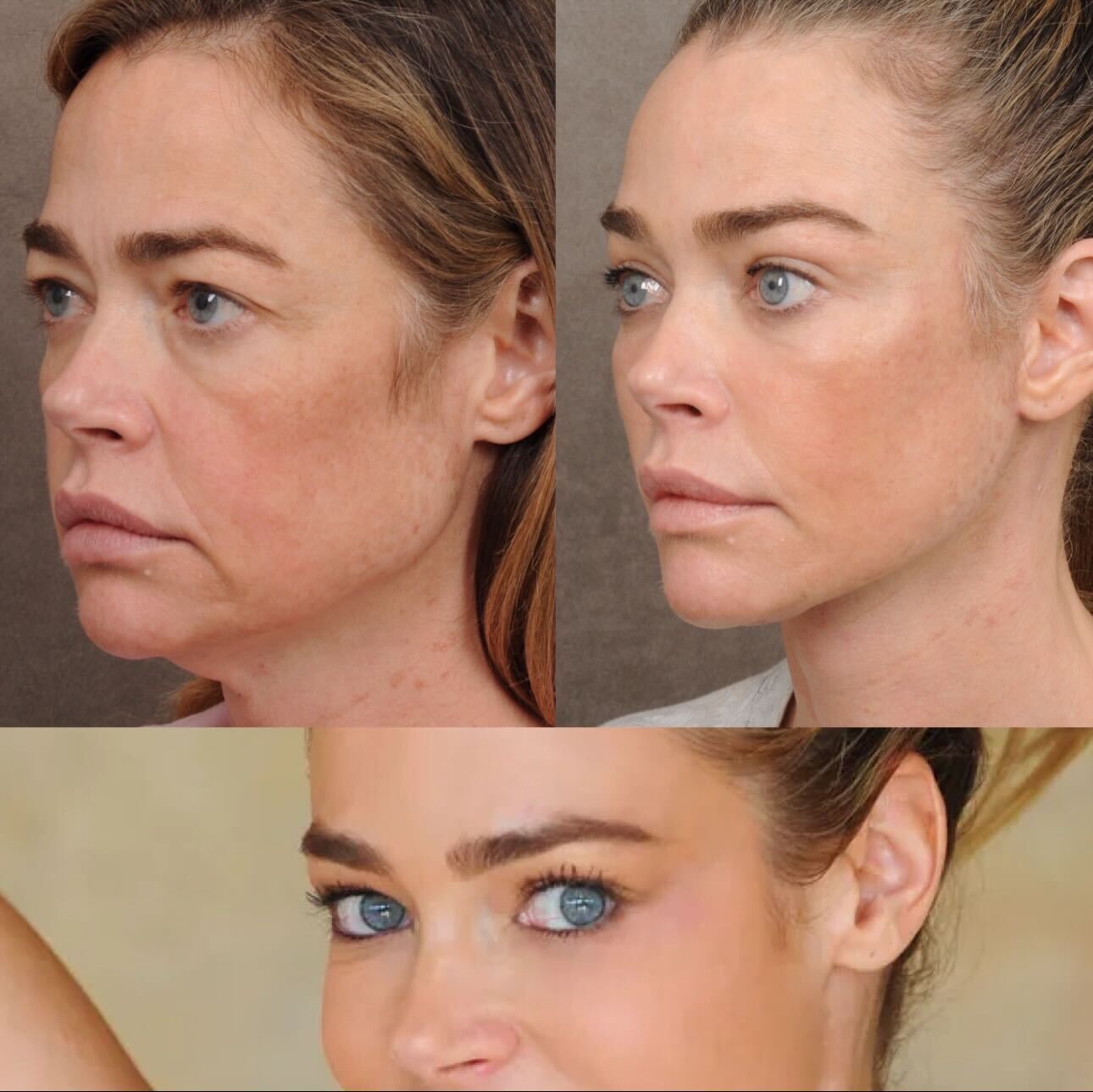 Секс-символ 90-х и звезда Playboy полностью перекроила лицо и поразила помолодевшим видом. Фото до и после