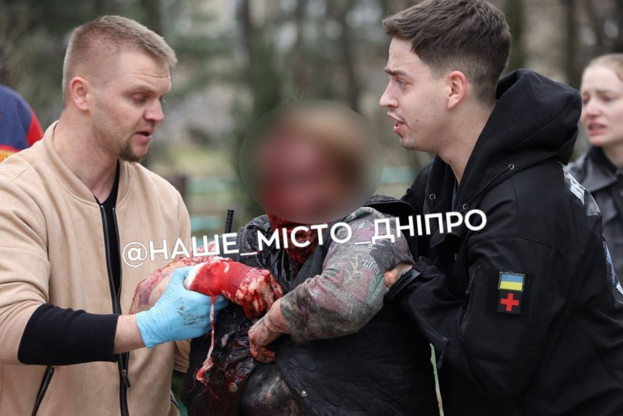В Днепре в результате вражеской атаки повреждена многоэтажка: пострадали 9 человек. Фото и видео