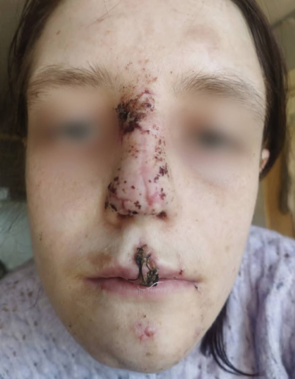 У Кривому Розі вівчарка розірвала обличчя дівчині під час стриму у ТікТок: деталі трагедії