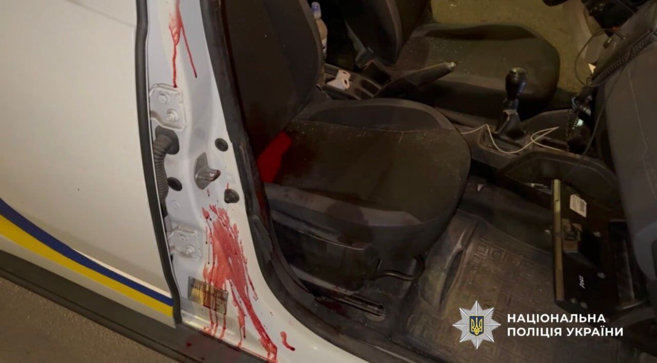 В Одесі водій авто відкрив стрілянину по поліцейських: нападника ліквідували під час затримання. Фото і відео