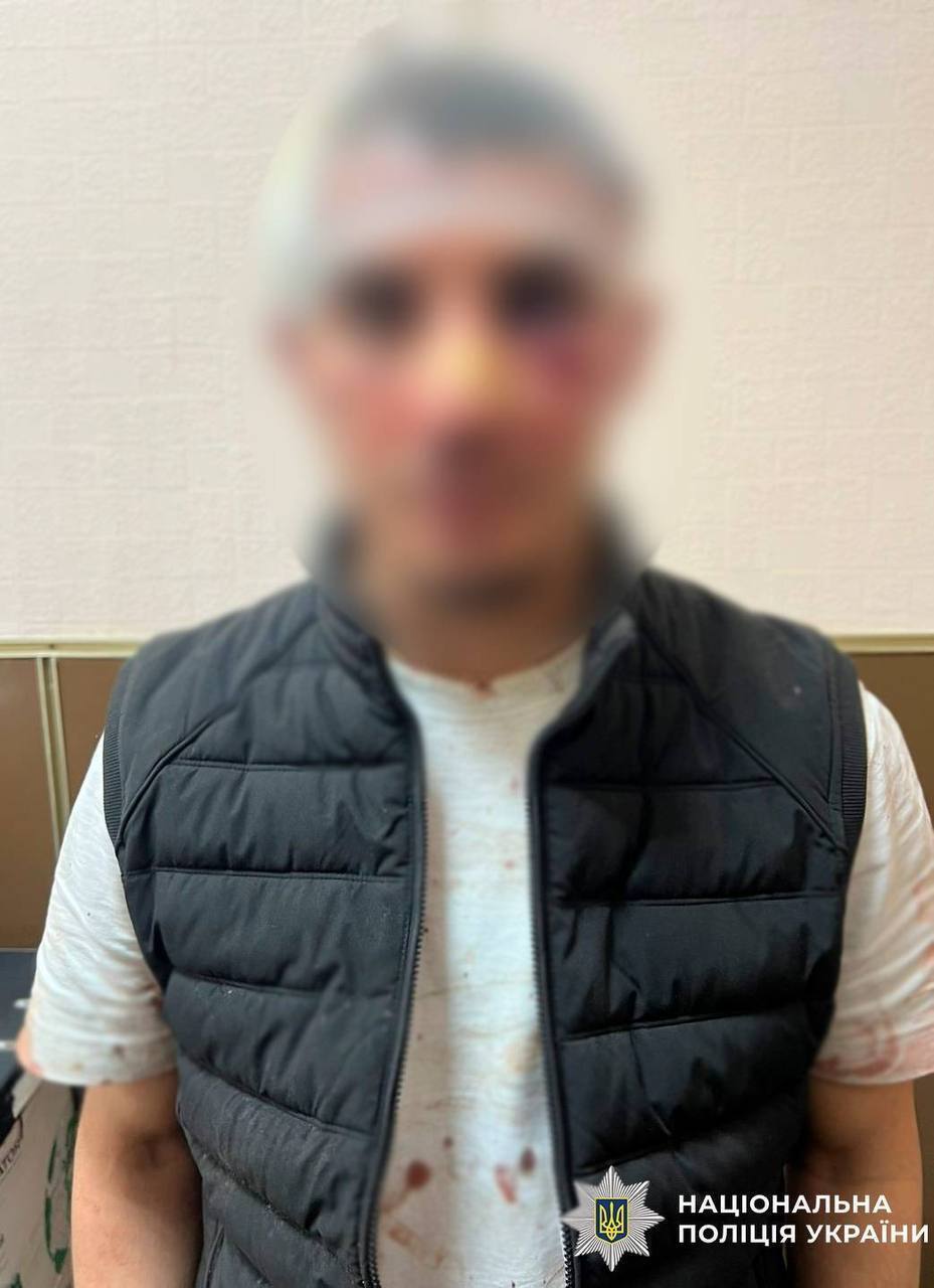 У центрі Києва іноземець з ножем напав на чоловіка: потерпілого госпіталізували. Подробиці та фото