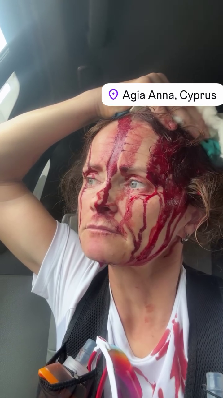 Чемпіонці Росії розгризли голову собаки під час пробіжки. Фото і відео