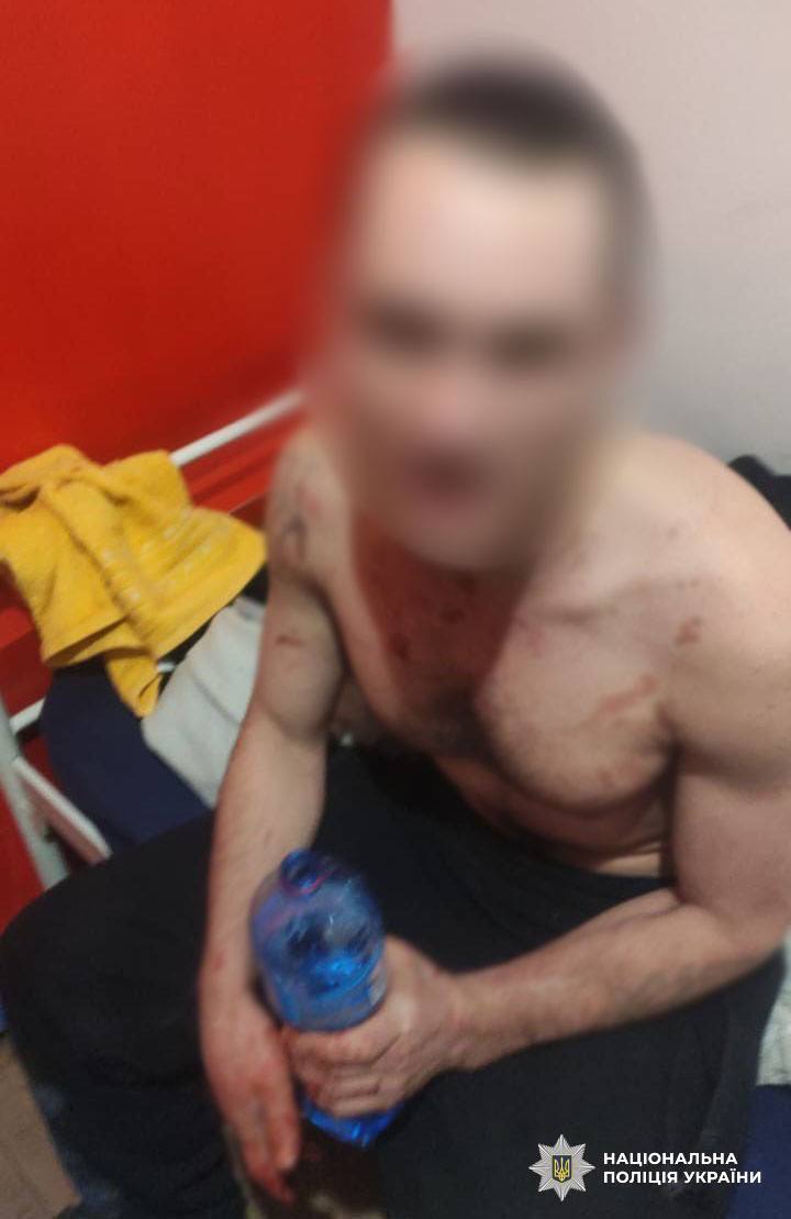 У Києві чоловік під час конфлікту з сусідом підірвав гранату у хостелі. Подробиці справи та фото
