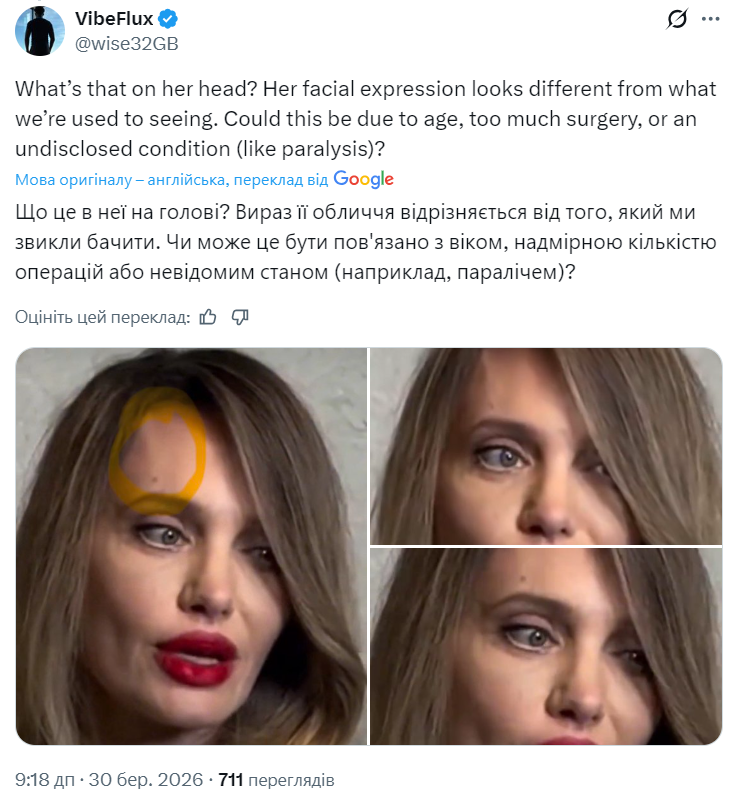 Параліч, двійник чи пластика? Новий вихід Анджеліни Джолі на червону доріжку спантеличив мережу. Фото