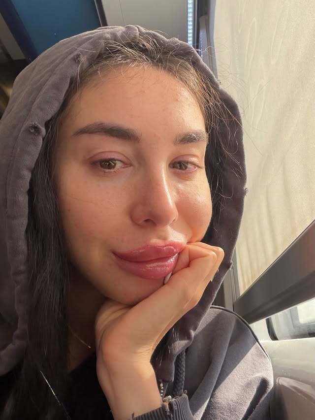 "Працюю з психологом". Дівчина вбитого на Балі Ігоря Комарова порушила тривале мовчання та пояснила, як житиме після трагедії