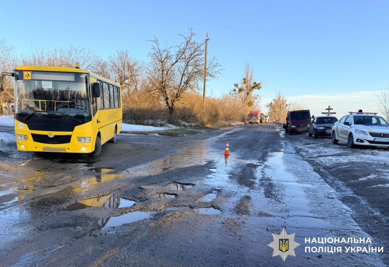 На Киевщине микроавтобус сбил 12-летнюю девочку: ребенок в тяжелом состоянии в больнице. Подробности ДТП и фото