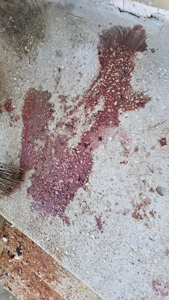 Окупанти атакували лікарню в Херсоні: постраждали четверо медиків. Фото