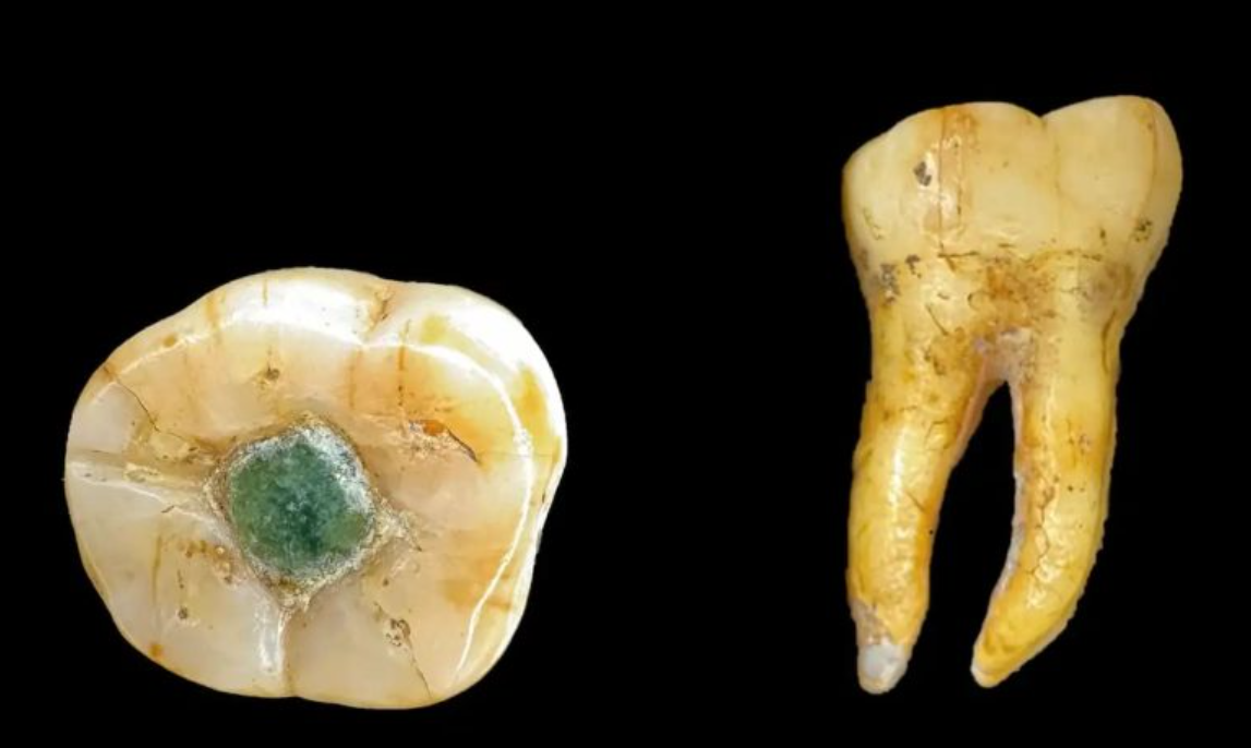 Мая пломбували зуби дорогоцінним камінням: вчені знайшли доказ. Фото