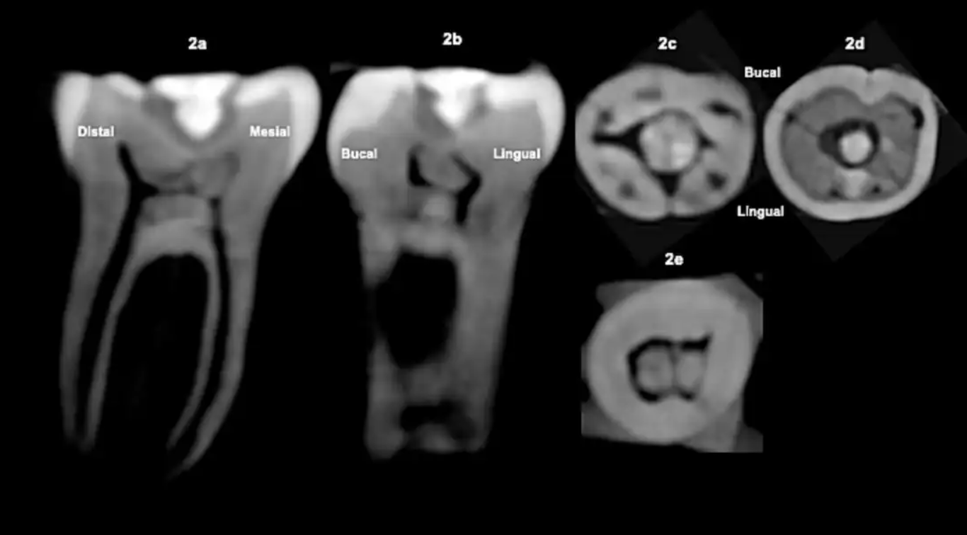 Мая пломбували зуби дорогоцінним камінням: вчені знайшли доказ. Фото