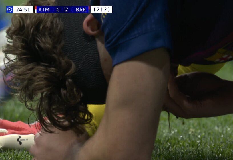 Воротар "Барселони" шипами бутс розрізав обличчя супернику в матчі Ліги чемпіонів. Відео