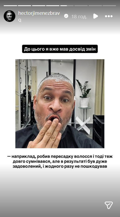 Ектор Хіменес-Браво зробив пластичну операцію та показав, який вигляд має його обличчя тепер. Фото