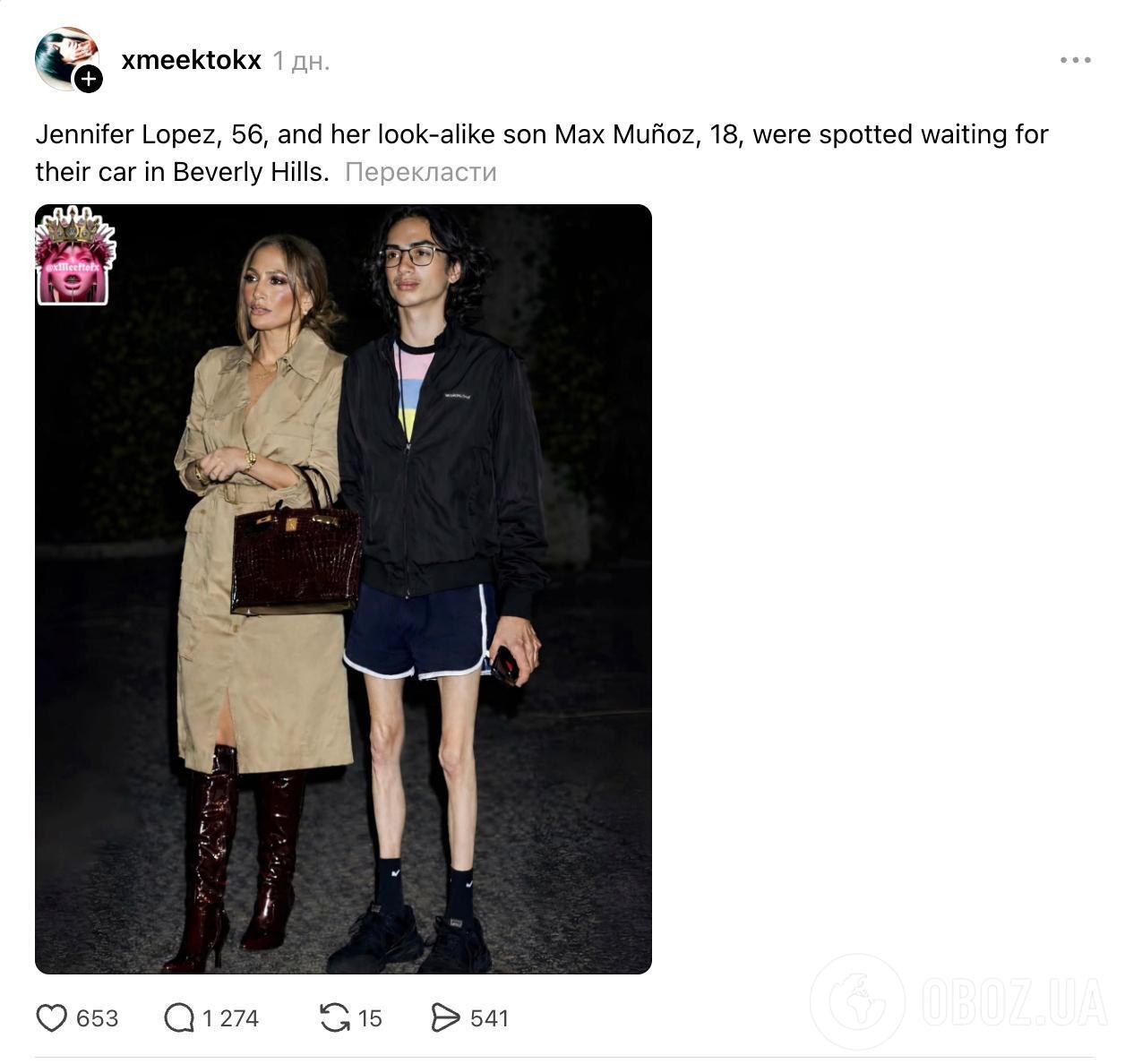 Ноги 18-річного сина Дженніфер Лопес не на жарт налякали мережу: фанати благають допомогти йому