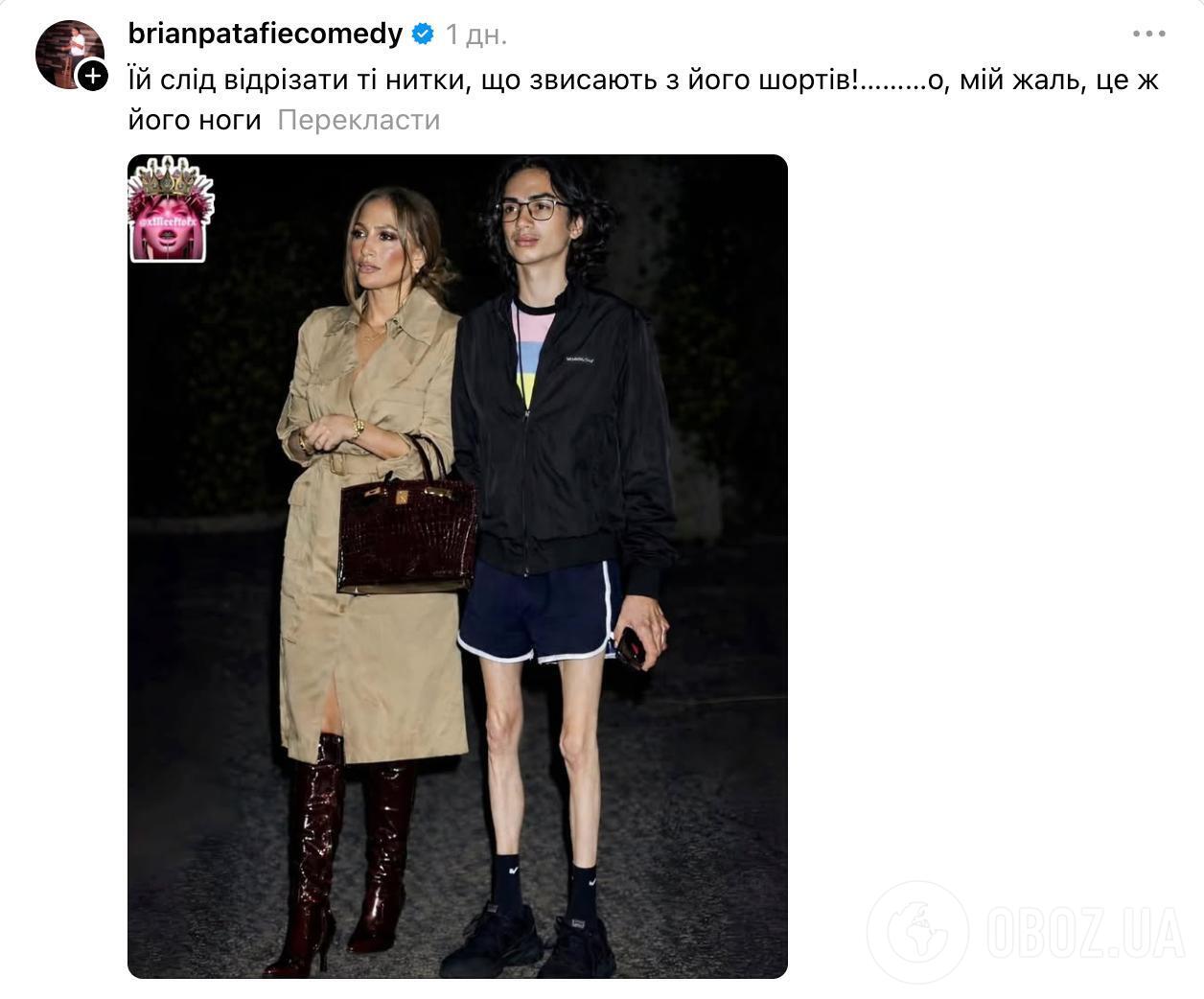 Ноги 18-річного сина Дженніфер Лопес не на жарт налякали мережу: фанати благають допомогти йому