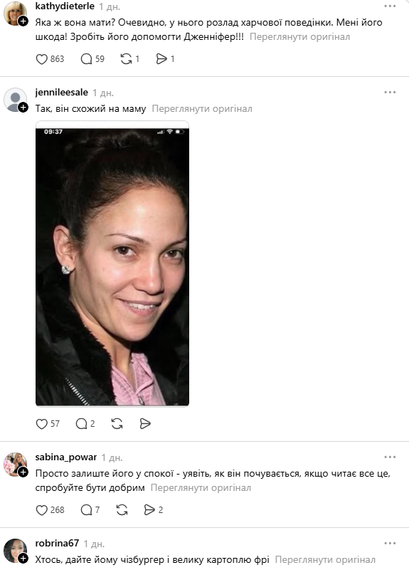 Ноги 18-річного сина Дженніфер Лопес не на жарт налякали мережу: фанати благають допомогти йому