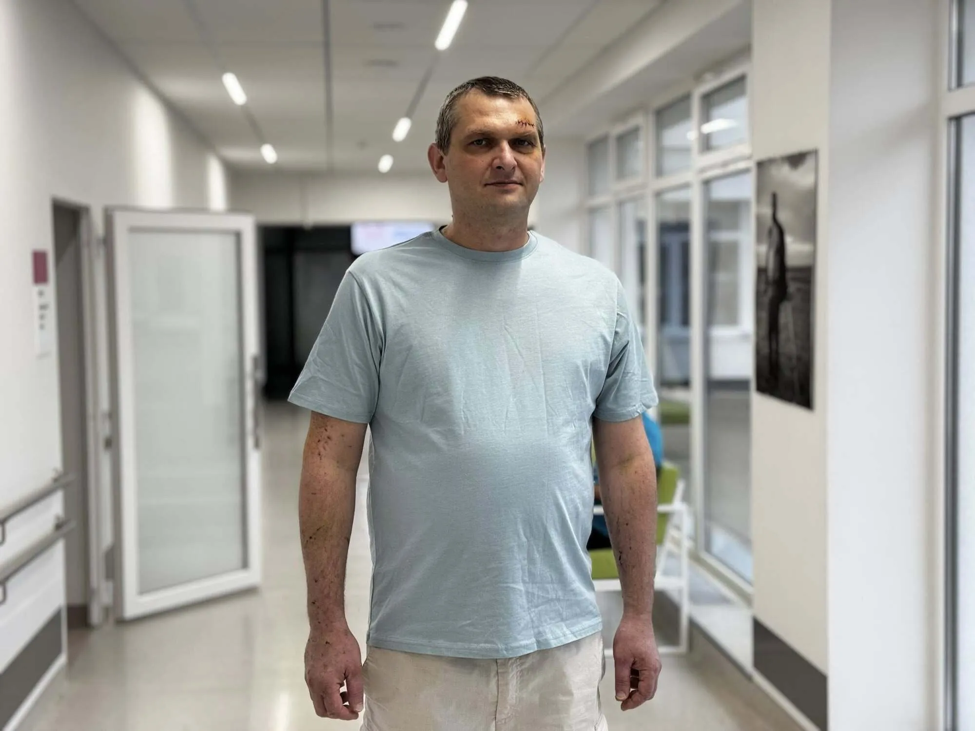 Во Львове спасли мужчину, у которого в легких застрял 10-сантиметровый кусок стекла после атаки РФ. Фото